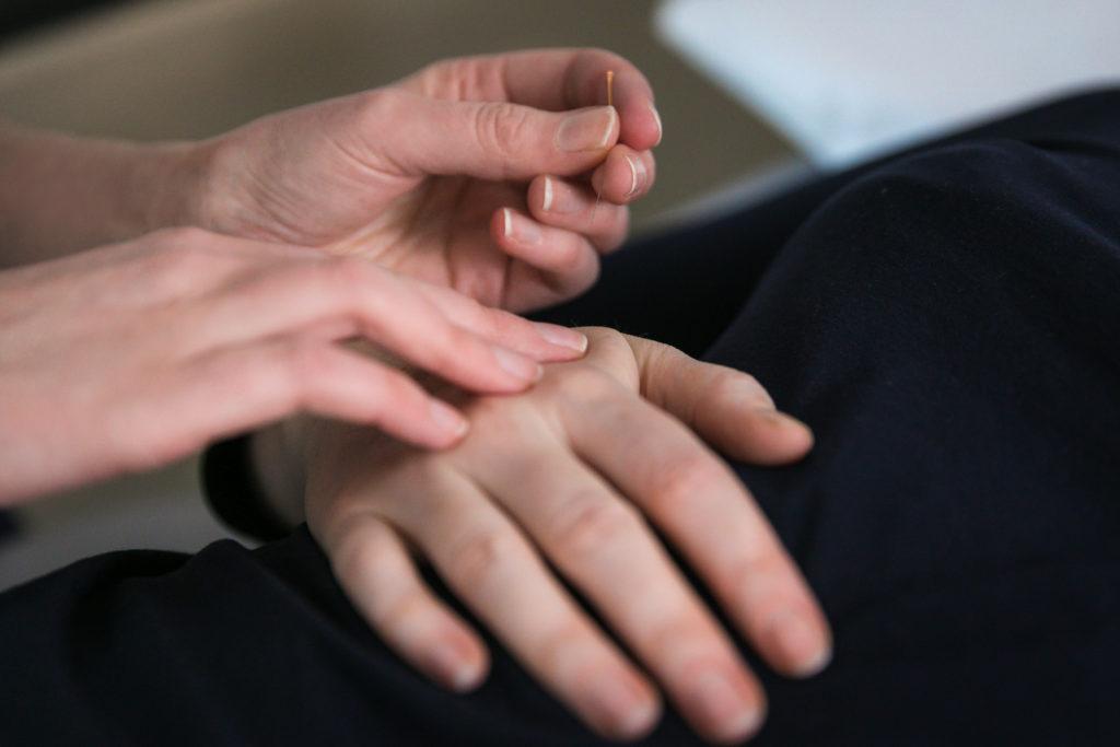 Acupuncturist holding acupuncture needle close to patient's hand